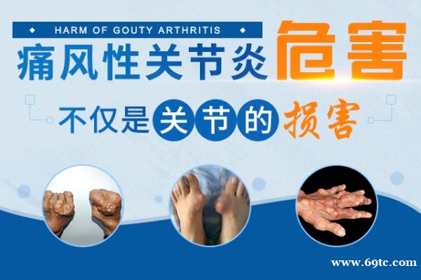 痛风的危害有哪些呢 痛风的危害有哪些呢