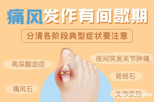 痛风急性发作症状?痛风的早期症状都有哪些呢 痛风急性发作症状?痛风的早期症状都有哪些呢