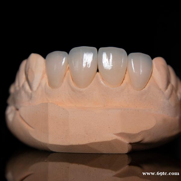 深圳义齿工厂出口贸易 深圳假牙加工厂 贴面 种植牙 隐形牙套 深圳义齿工厂出口贸易 深圳假牙加工厂 贴面 种植牙 隐形牙套